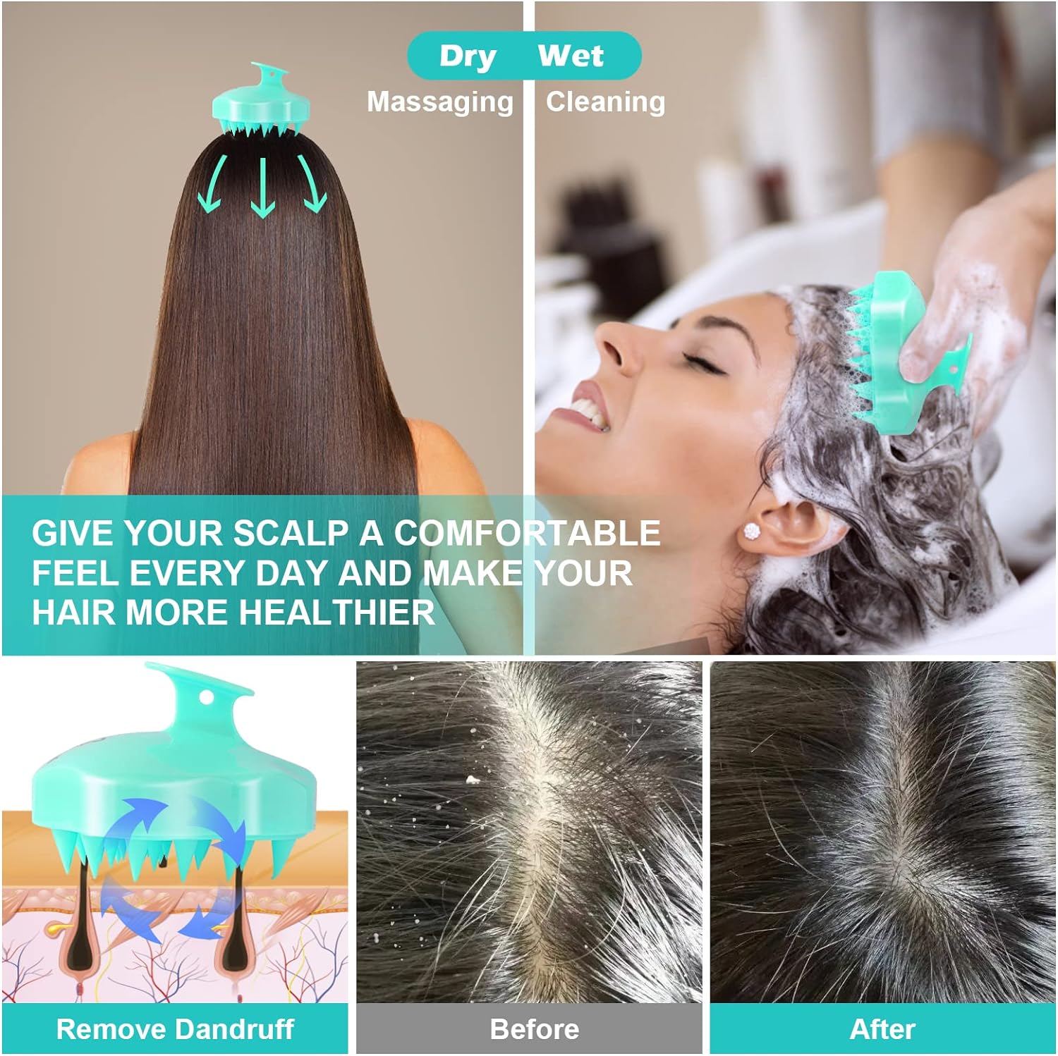 Hair Scalp Massager, Shampoo Brush, Pets Hair Care Tool Hair Scalp Massager, Shampoo Brush, Pets Hair Care Tool